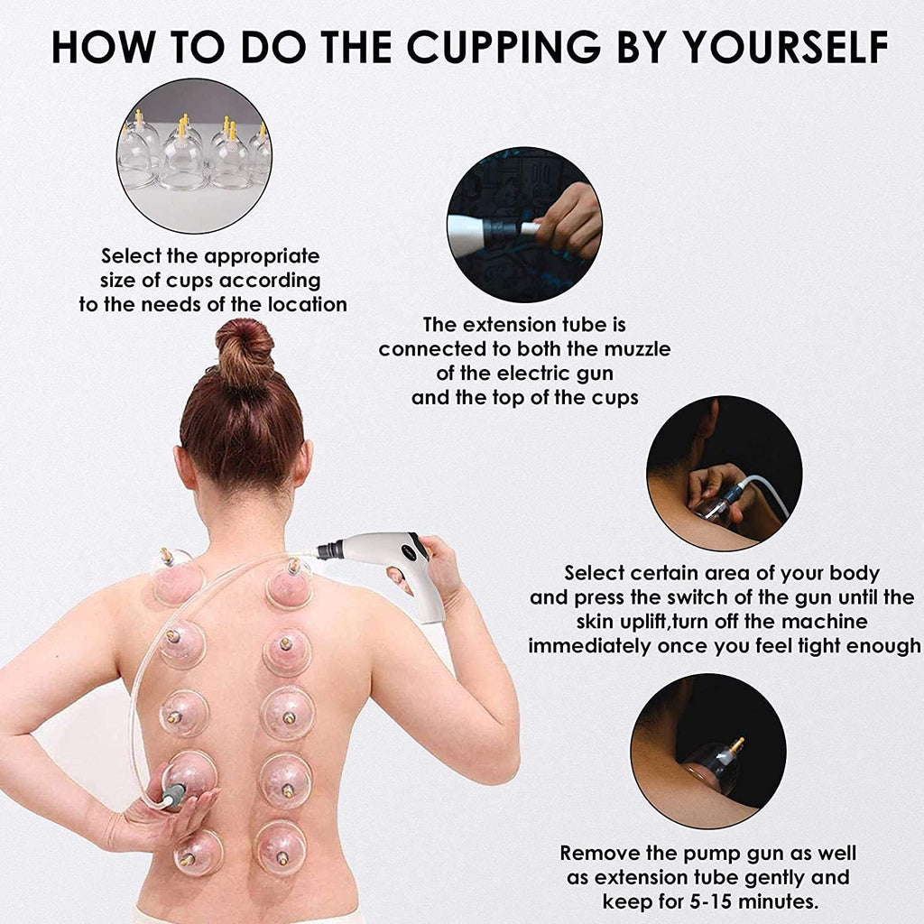 COOBST Chinese Cupping Set — Relaxation & Body Massage